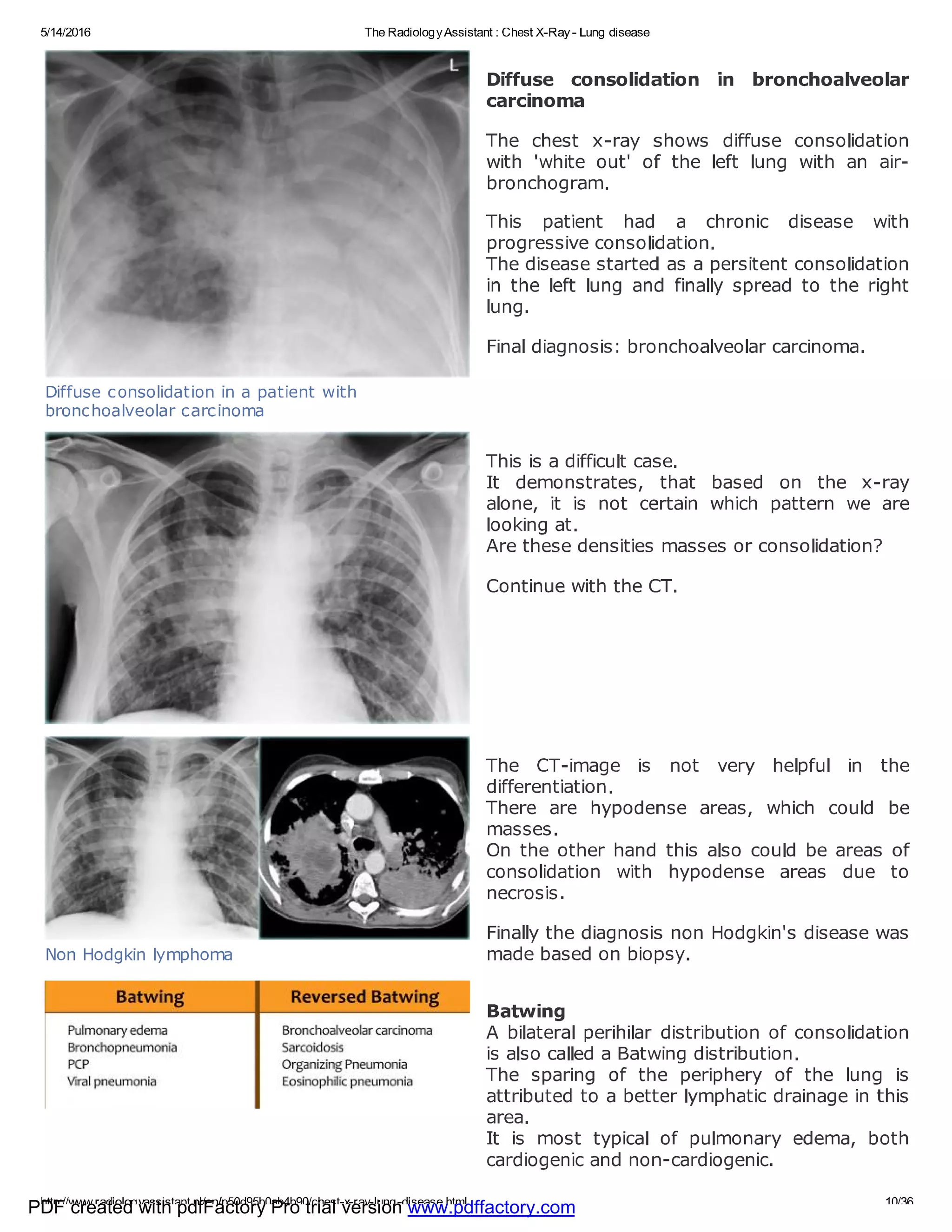Chest x ray - lung disease | PDF