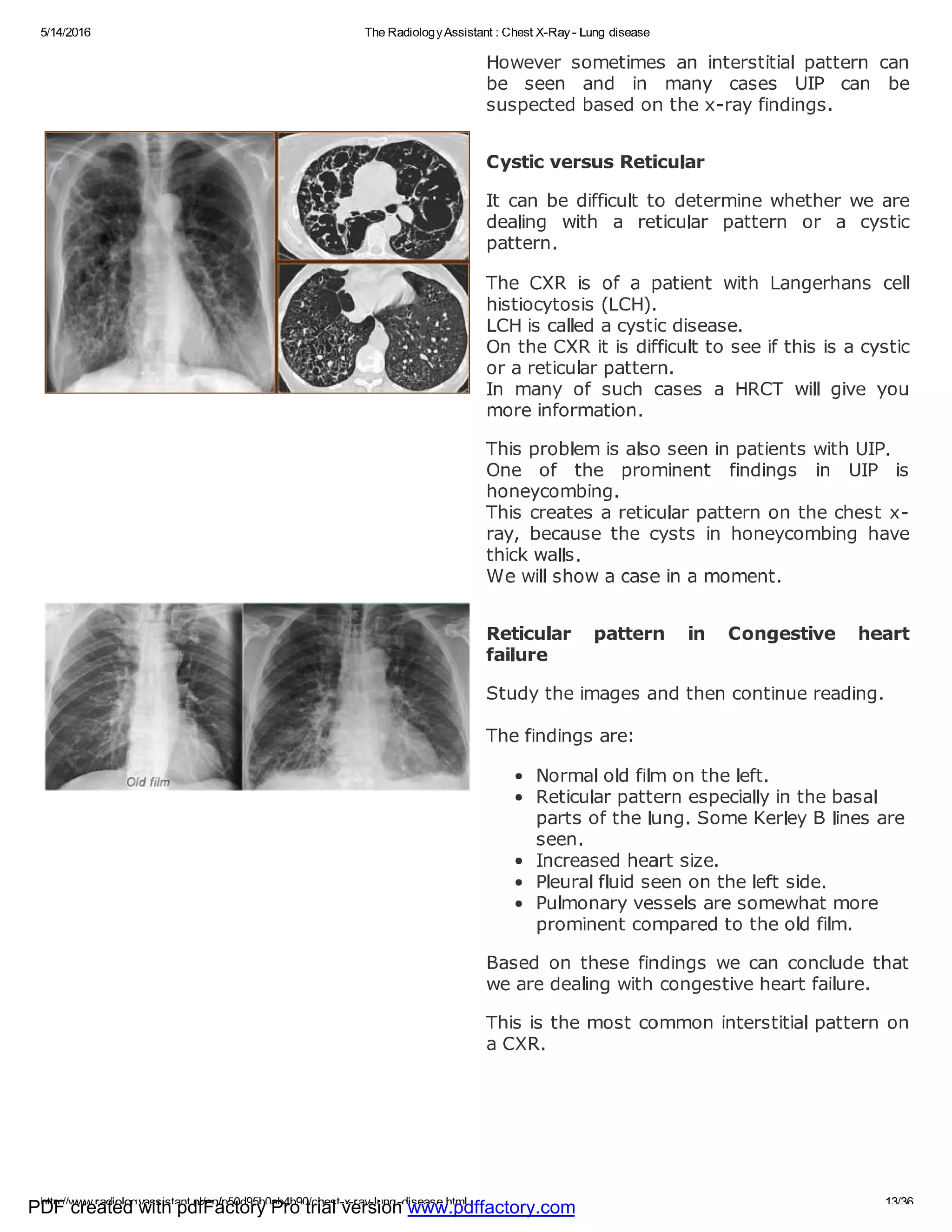 Chest x ray - lung disease | PDF
