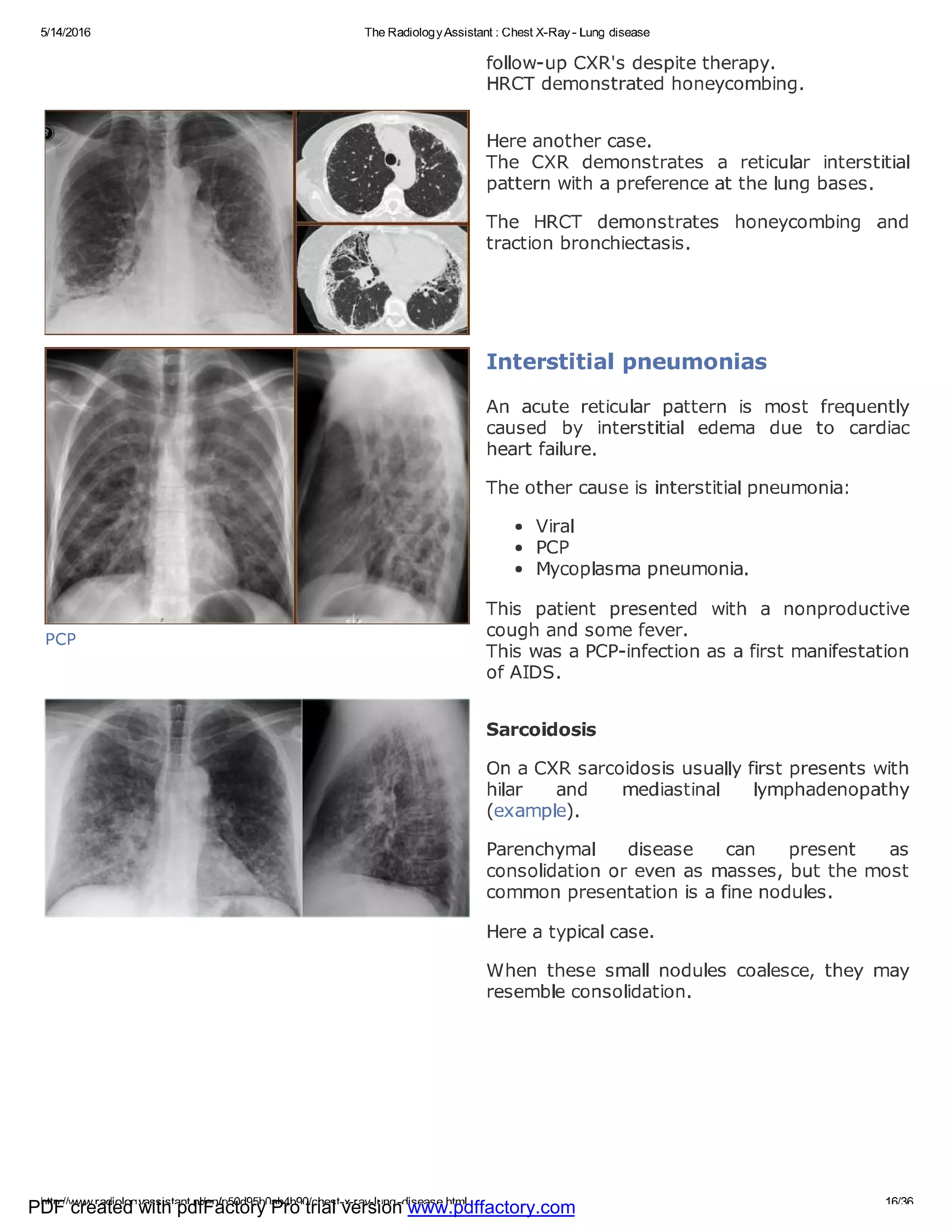 Chest x ray - lung disease | PDF