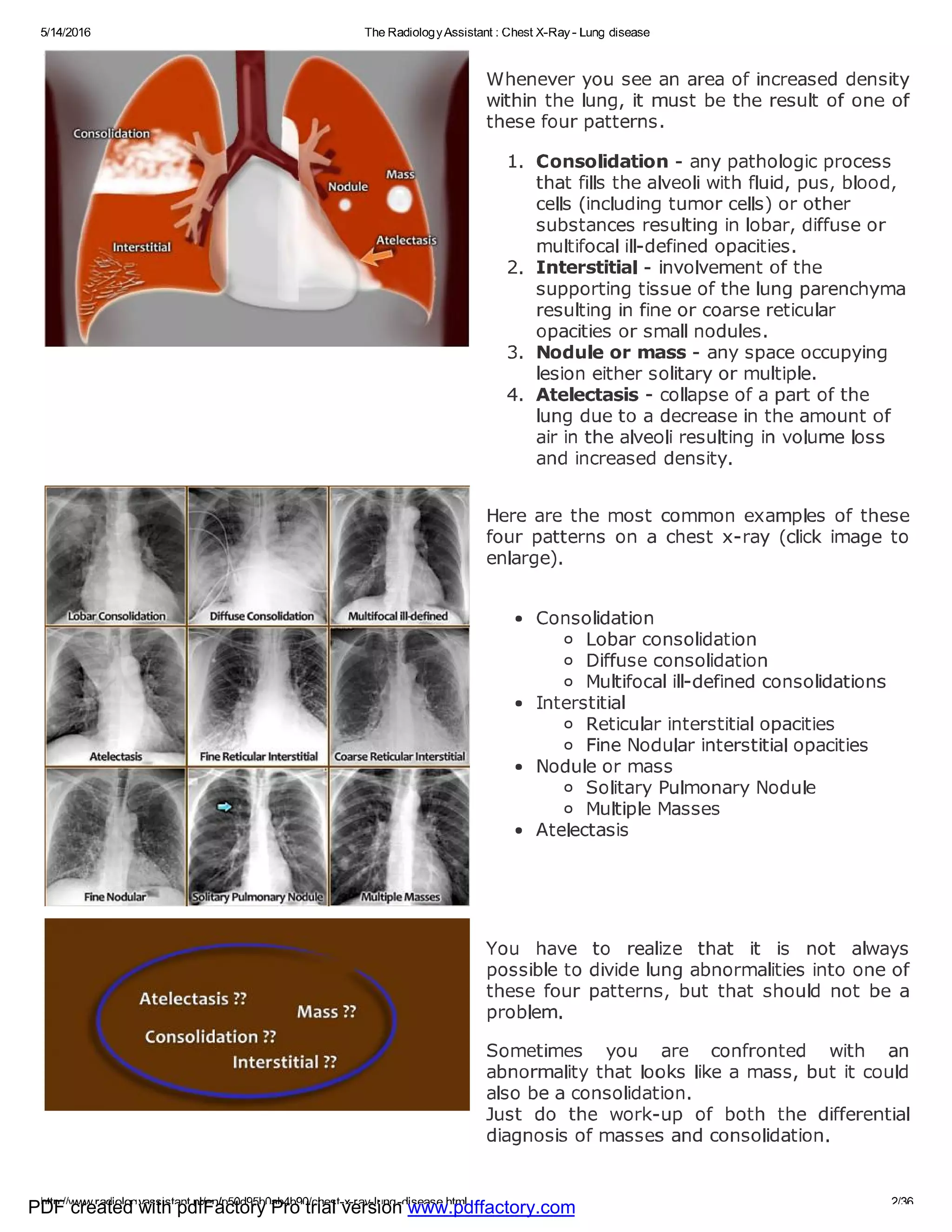 Chest x ray - lung disease | PDF