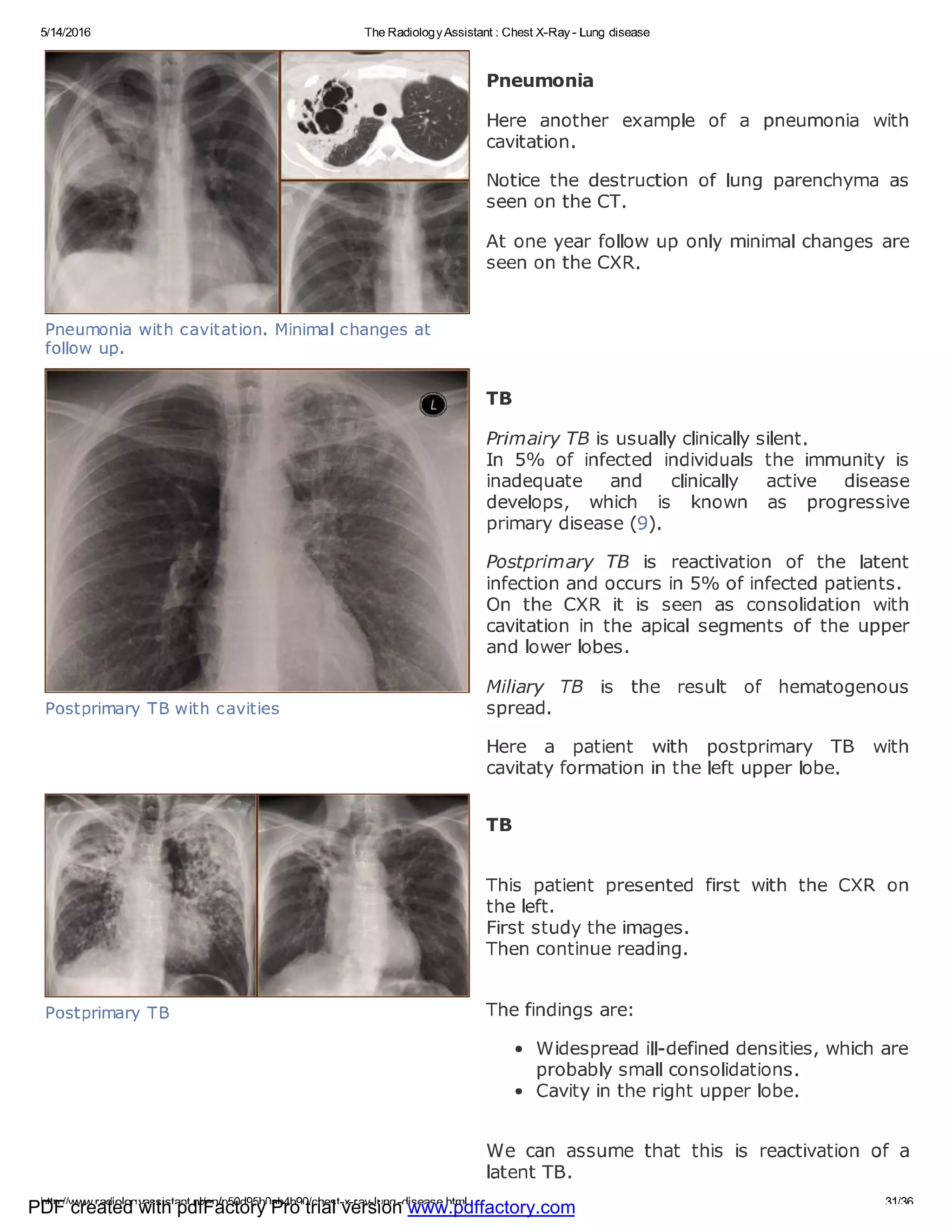 Chest x ray - lung disease | PDF