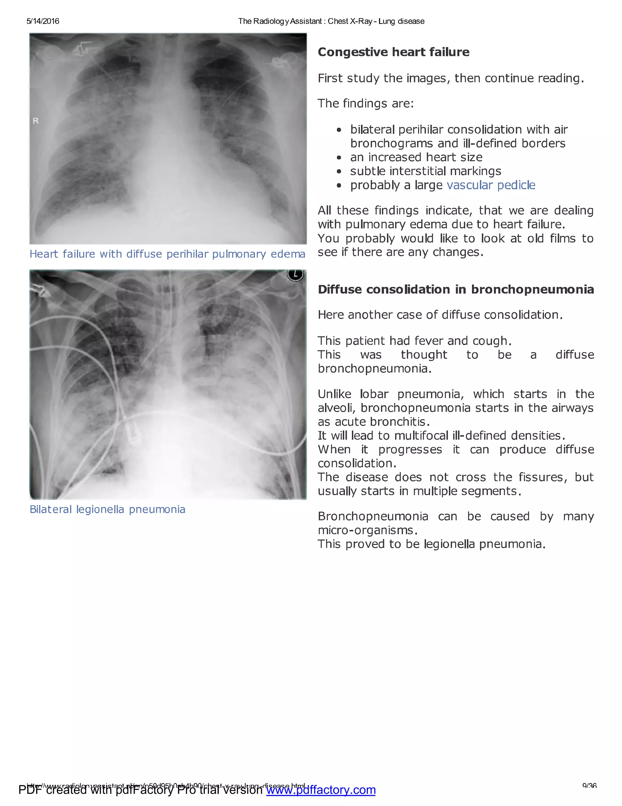 Chest x ray - lung disease | PDF
