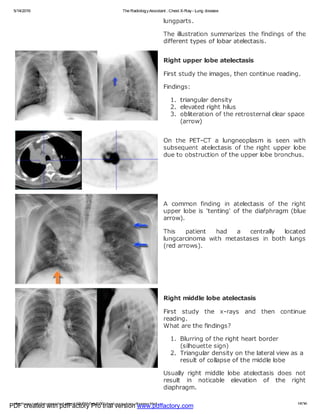 PDF created with pdfFactory Pro trial version www.pdffactory.com
 