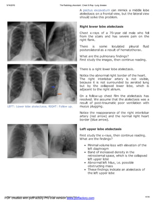 PDF created with pdfFactory Pro trial version www.pdffactory.com
 