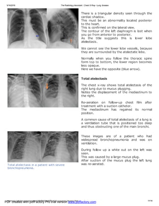 PDF created with pdfFactory Pro trial version www.pdffactory.com
 