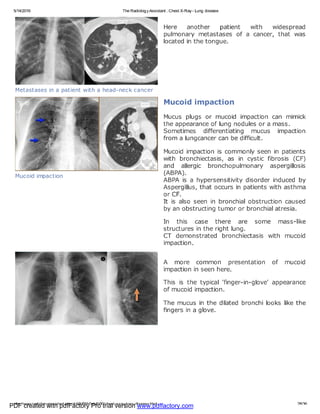 PDF created with pdfFactory Pro trial version www.pdffactory.com
 