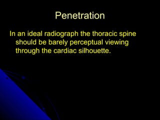 12 
PPeenneettrraattiioonn 
IInn aann iiddeeaall rraaddiiooggrraapphh tthhee tthhoorraacciicc ssppiinnee 
sshhoouulldd bbee bbaarreellyy ppeerrcceeppttuuaall vviieewwiinngg 
tthhrroouugghh tthhee ccaarrddiiaacc ssiillhhoouueettttee.. 
 
