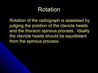 14 
RRoottaattiioonn 
RRoottaattiioonn ooff tthhee rraaddiiooggrraapphh iiss aasssseesssseedd bbyy 
jjuuddggiinngg tthhee ppoossiittiioonn ooff tthhee ccllaavviiccllee hheeaaddss 
aanndd tthhee tthhoorraacciicc ssppiinnoouuss pprroocceessss.. IIddeeaallllyy 
tthhee ccllaavviiccllee hheeaaddss sshhoouulldd bbee eeqquuiiddiissttaanntt 
ffrroomm tthhee ssppiinnoouuss pprroocceessss.. 
 