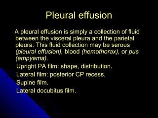 24 
PPlleeuurraall eeffffuussiioonn 
AA pplleeuurraall eeffffuussiioonn iiss ssiimmppllyy aa ccoolllleeccttiioonn ooff fflluuiidd 
bbeettwweeeenn tthhee vviisscceerraall pplleeuurraa aanndd tthhee ppaarriieettaall 
pplleeuurraa.. TThhiiss fflluuiidd ccoolllleeccttiioonn mmaayy bbee sseerroouuss 
((pplleeuurraall eeffffuussiioonn)),, bblloooodd ((hheemmootthhoorraaxx)),, oorr ppuuss 
((eemmppyyeemmaa)).. 
UUpprriigghhtt PPAA ffiillmm:: sshhaappee,, ddiissttrriibbuuttiioonn.. 
LLaatteerraall ffiillmm:: ppoosstteerriioorr CCPP rreecceessss.. 
SSuuppiinnee ffiillmm.. 
LLaatteerraall ddooccuubbiittuuss ffiillmm.. 
 