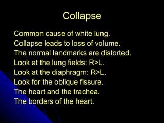 30 
CCoollllaappssee 
CCoommmmoonn ccaauussee ooff wwhhiittee lluunngg.. 
CCoollllaappssee lleeaaddss ttoo lloossss ooff vvoolluummee.. 
TThhee nnoorrmmaall llaannddmmaarrkkss aarree ddiissttoorrtteedd.. 
LLooookk aatt tthhee lluunngg ffiieellddss:: RR>>LL.. 
LLooookk aatt tthhee ddiiaapphhrraaggmm:: RR>>LL.. 
LLooookk ffoorr tthhee oobblliiqquuee ffiissssuurree.. 
TThhee hheeaarrtt aanndd tthhee ttrraacchheeaa.. 
TThhee bboorrddeerrss ooff tthhee hheeaarrtt.. 
 