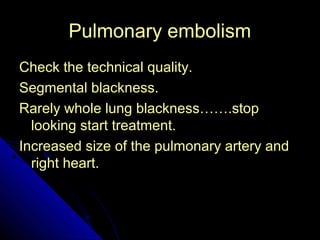 PPuullmmoonnaarryy eemmbboolliissmm 
CChheecckk tthhee tteecchhnniiccaall qquuaalliittyy.. 
SSeeggmmeennttaall bbllaacckknneessss.. 
RRaarreellyy wwhhoollee lluunngg bbllaacckknneessss…………..ssttoopp 
llooookkiinngg ssttaarrtt ttrreeaattmmeenntt.. 
IInnccrreeaasseedd ssiizzee ooff tthhee ppuullmmoonnaarryy aarrtteerryy aanndd 
rriigghhtt hheeaarrtt.. 
51 
 