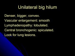 UUnniillaatteerraall bbiigg hhiilluumm 
54 
DDeennsseerr,, bbiiggggeerr,, ccoonnvveexx.. 
VVaassccuullaarr eennllaarrggeemmeenntt:: ssmmooootthh 
LLyymmpphhaaddeennooppaatthhyy:: lloobbuullaatteedd.. 
CCeennttrraall bbrroonncchhooggeenniicc:: ssppiiccuullaatteedd.. 
LLooookk ffoorr lluunngg lleessiioonnss.. 
 
