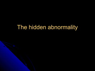 TThhee hhiiddddeenn aabbnnoorrmmaalliittyy 
65 
 