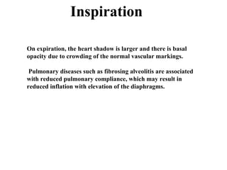 Chest x ray and other imaging investigations of chest by dr bishnu | PDF
