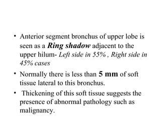 Chest x ray and other imaging investigations of chest by dr bishnu | PDF