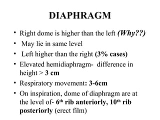 Chest x ray and other imaging investigations of chest by dr bishnu | PDF