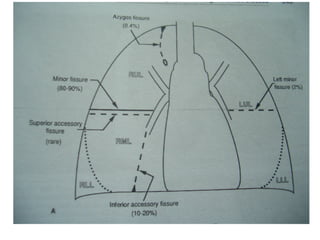 Chest x ray and other imaging investigations of chest by dr bishnu | PDF