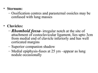 Chest x ray and other imaging investigations of chest by dr bishnu | PDF
