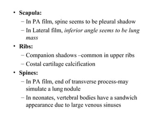 Chest x ray and other imaging investigations of chest by dr bishnu | PDF