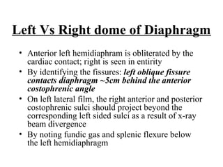 Chest x ray and other imaging investigations of chest by dr bishnu | PDF