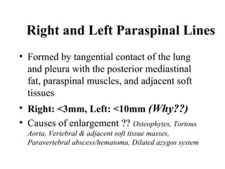 Chest x ray and other imaging investigations of chest by dr bishnu | PDF