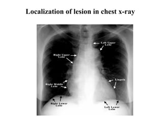 Chest x ray and other imaging investigations of chest by dr bishnu | PDF