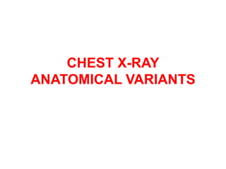 CHEST X-RAY
ANATOMICAL VARIANTS
 