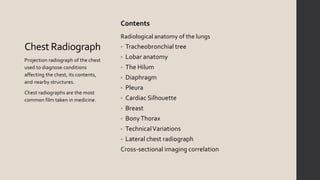 Chest X-ray: The Basics | PPTX