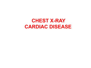 CHEST X-RAY
CARDIAC DISEASE
 