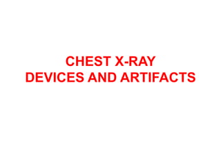 CHEST X-RAY
DEVICES AND ARTIFACTS
 