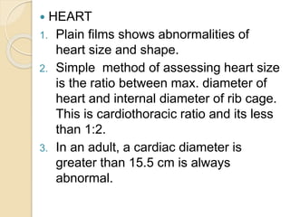 CHEST X-RAY F.pptx