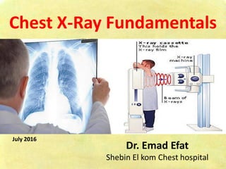Chest X-Ray Fundamentals
Dr. Emad Efat
Shebin El kom Chest hospital
July 2016
 