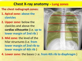 Chest X-ray Fundamentals on Acquisition and Interpretation.pdf