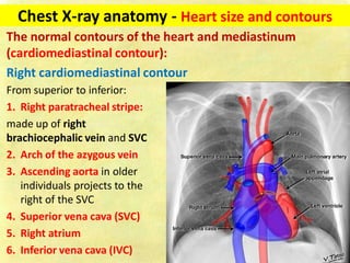 chest-x-ray-fundamentals-on-acquisition-and-interpretation-pdf