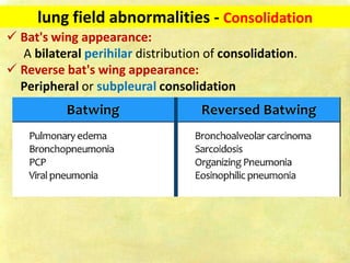 Chest X-ray Fundamentals on Acquisition and Interpretation.pdf