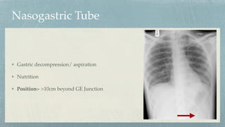 Nasogastric Tube
Gastric decompression/ aspiration
Nutrition
Position:- >10cm beyond GE Junction
 