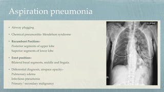Aspiration pneumonia
Airway plugging
Chemical pneumonitis- Mendelson syndrome
Recumbent Position:-
Posterior segments of upper lobe
Superior segments of lower lobe
Erect position:-
Bilateral basal segments, middle and lingula.
Differential diagnosis, airspace opacity:-
Pulmonary edema
Infectious pneumonia
Primary/ secondary malignancy
 