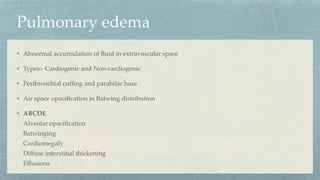Pulmonary edema
Abnormal accumulation of
fl
uid in extravascular space
Types:- Cardiogenic and Non-cardiogenic
Peribronchial cuf
fi
ng and parahilar haze
Air space opaci
fi
cation in Batwing distribution
ABCDE
Alveolar opaci
fi
cation
Batwinging
Cardiomegaly
Diffuse interstitial thickening
Effusions
 