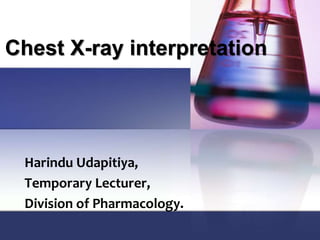 Chest X-ray interpretation
Harindu Udapitiya,
Temporary Lecturer,
Division of Pharmacology.
 