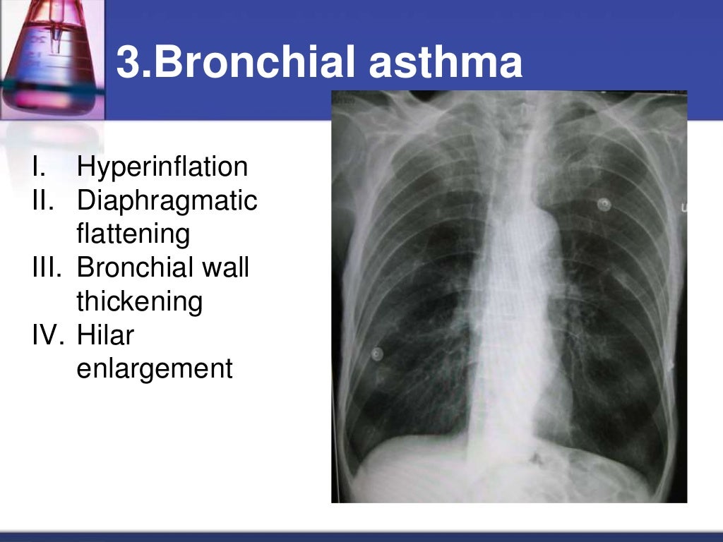 Chest x ray interpretation