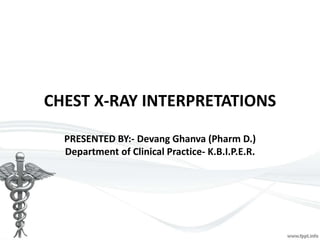 CHEST X-RAY INTERPRETATIONS
PRESENTED BY:- Devang Ghanva (Pharm D.)
Department of Clinical Practice- K.B.I.P.E.R.
 