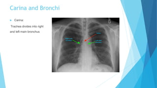 Carina and Bronchi
 Carina:
Trachea divides into right
and left main bronchus
 