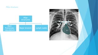 Hilar structures
Hilar
structures
Main
Pulmonary
vasculature
Major bronchi Lymph nodes
 