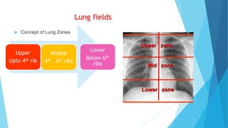 Lung fields
 Concept of Lung Zones
Upper
Upto 4th rib
Middle
4th – 6th ribs
Lower
Below 6th
ribs
 