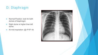 D: Diaphragm
 Normal Position: look for both
domes of diaphragm
 Right dome is higher than left
dome.
 At mid-inspiration: @ 4th/5th rib
 