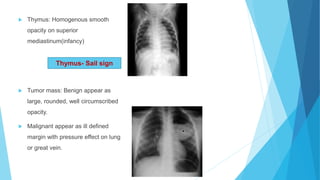  Thymus: Homogenous smooth
opacity on superior
mediastinum(infancy)
 Tumor mass: Benign appear as
large, rounded, well circumscribed
opacity.
 Malignant appear as ill defined
margin with pressure effect on lung
or great vein.
Thymus- Sail sign
 