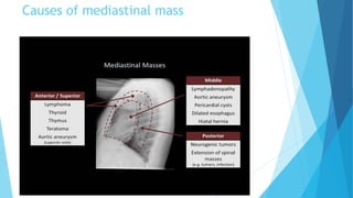 Causes of mediastinal mass
 