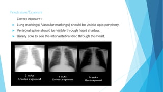 Penetration/Exposure
Correct exposure :
 Lung markings( Vascular markings) should be visible upto periphery.
 Vertebral spine should be visible through heart shadow.
 Barely able to see the intervertebral disc through the heart.
 