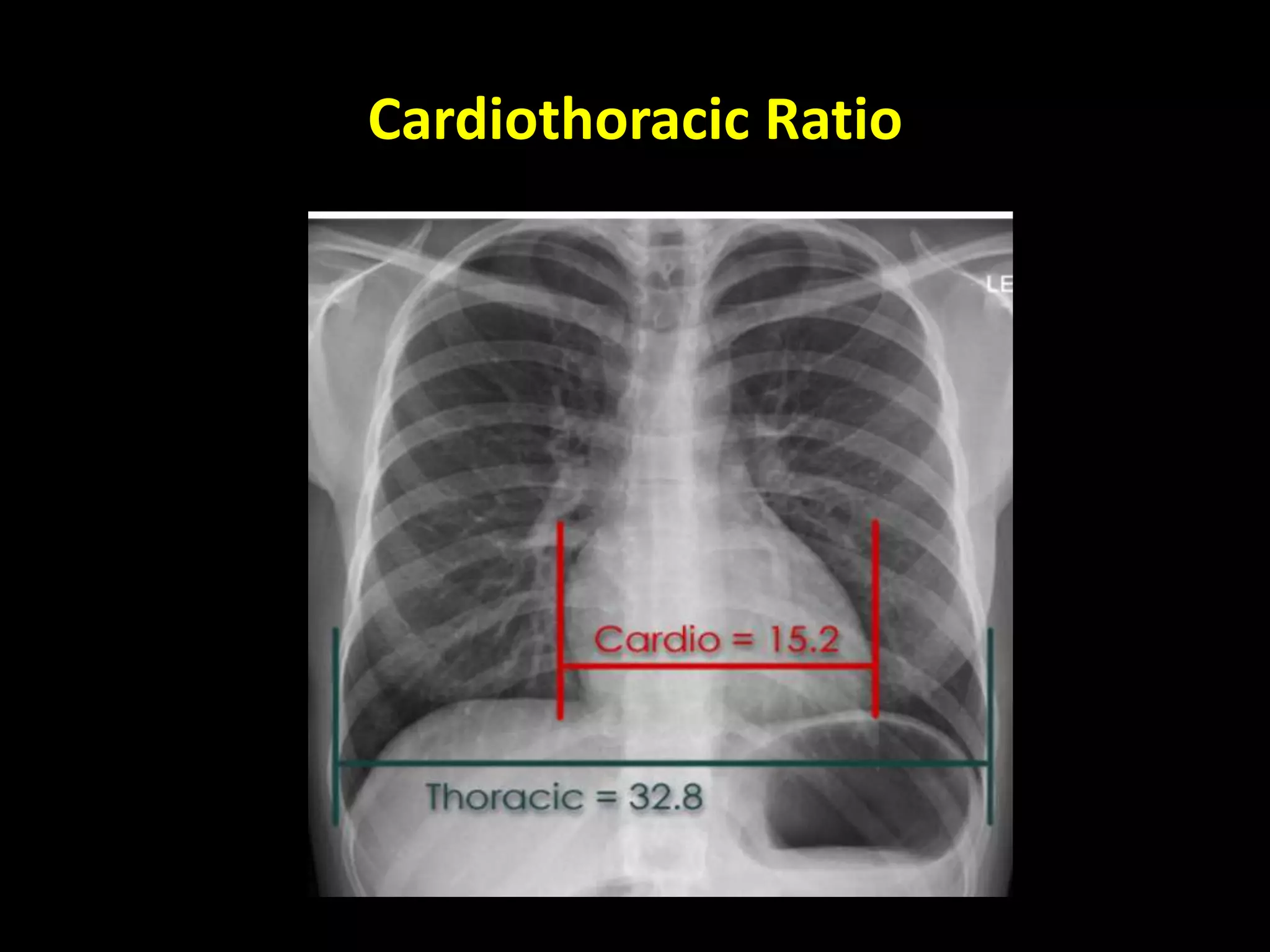 Chest X-ray Interpretation.pptx