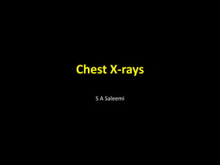 Chest X-rays
S A Saleemi
 